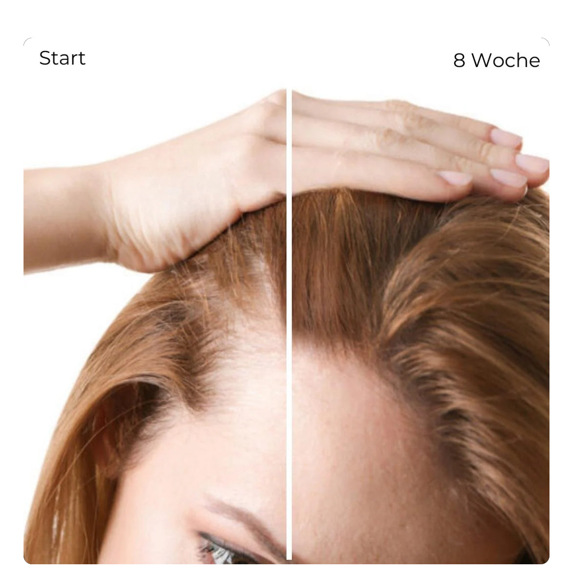 3 in 1 Massagebürste + 1 Kostenloses Öl